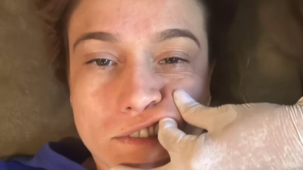 Diagnosticada com Paralisia, Fernanda Gentil exibe tratamento: ‘fisioterapia’