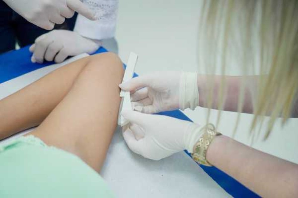 Implanon: Implante contraceptivo é tema de capacitação com médicos e enfermeiros da rede pública