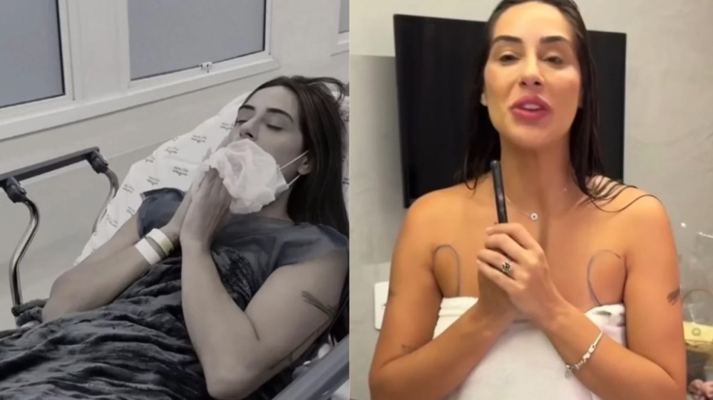 Ex-BBB, Deniziane realiza cirurgia plástica e compartilha com fãs: ‘Uma nova mulher’