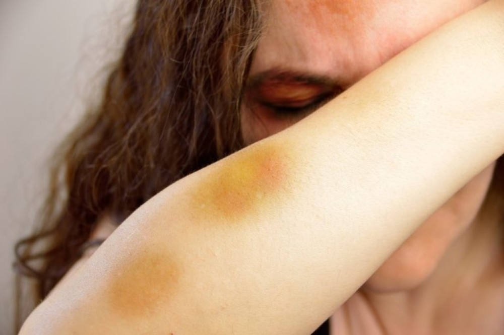 Nova lei dá prioridade para atendimento a vítimas de violência doméstica