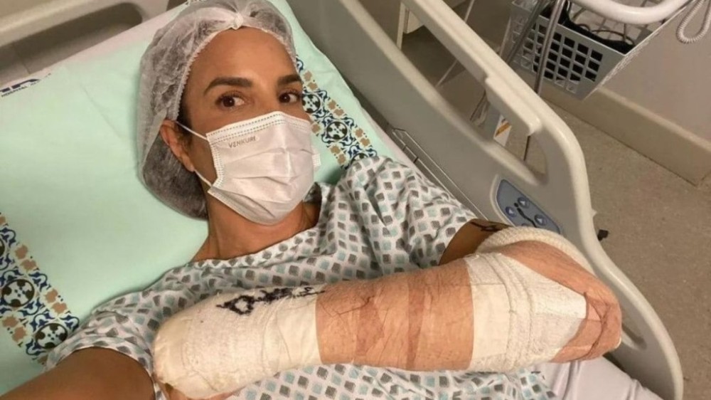 Ivete Sangalo aparece imobilizada e revela cirurgia