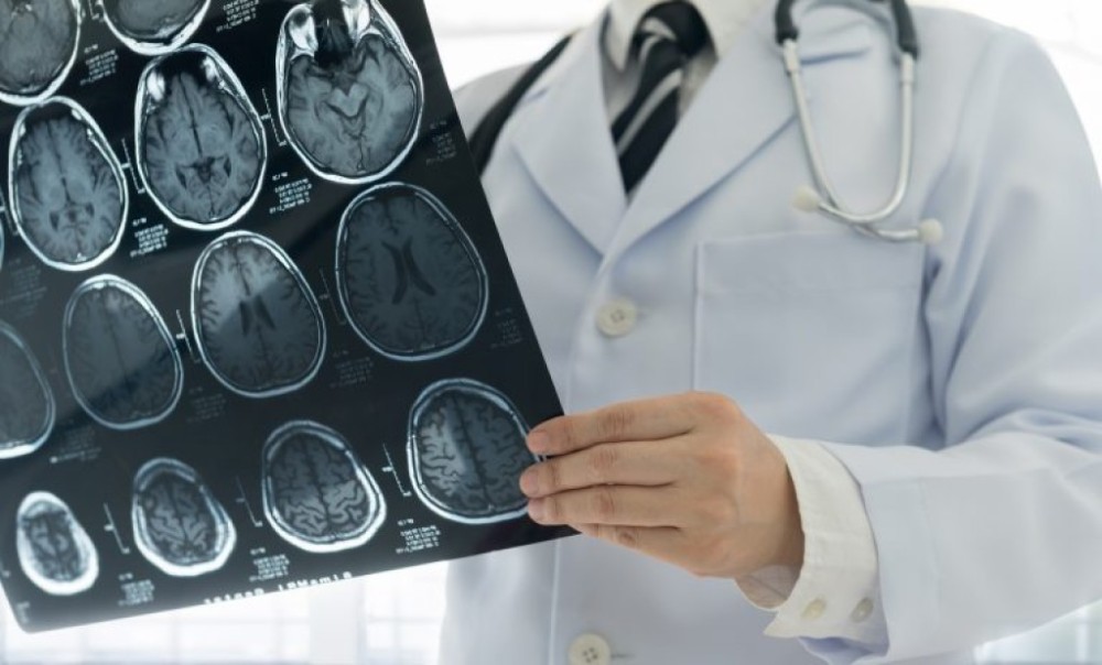 Lei cria o Dia Nacional de Prevenção ao Acidente Vascular Cerebral