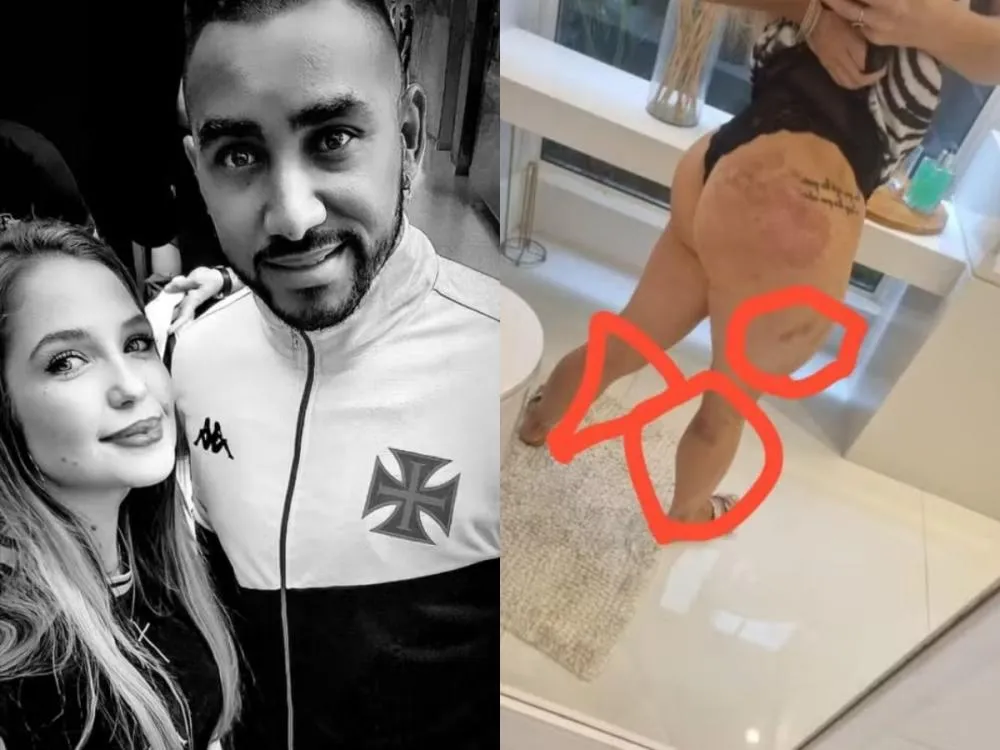Perícia confirma lesões em advogada que acusa Payet, jogador do Vasco, de agressão Larissa Ferrari abriu um boletim de ocorrência contra o jogador francês Dimitri Payet e o acusou de fazer ameaças veladas; a advogada também pediu uma medida protetiva