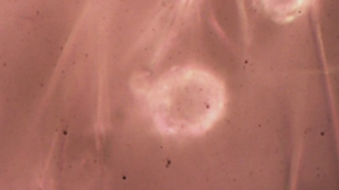 Pela 1ª vez no Brasil, cientistas acham microplástico em cordão umbilical Detecção é a primeira também na América Latina; estudo publicado nesta sexta-feira (25) detectou mais de 200 partículas em amostras de dez gestantes em Maceió (AL)