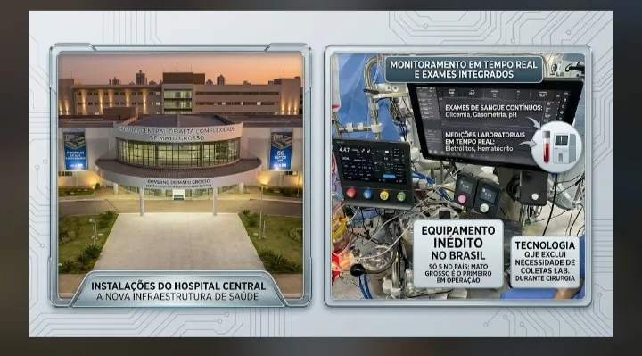 Coluna Anamaria: TECNOLOGIA INÉDITA NO SUS: Mato Grosso sai na frente com uma conquista histórica para a saúde pública!